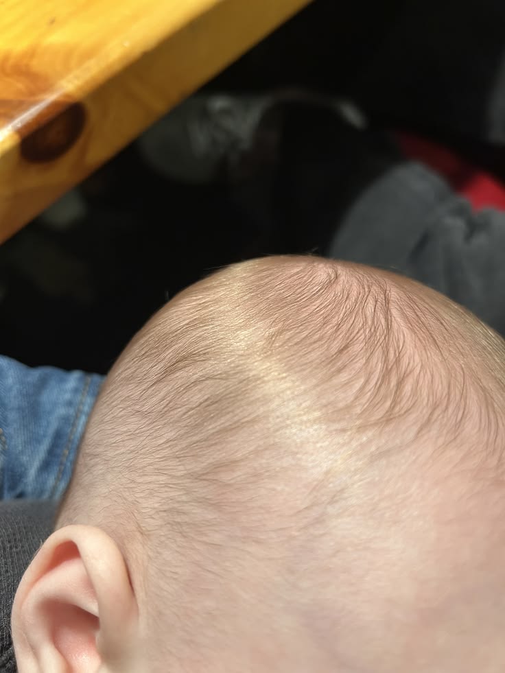 Close-up of a young baby's scalp showing fine, thin hair still filling in unevenly, typical of hair growth during the first few months of life."