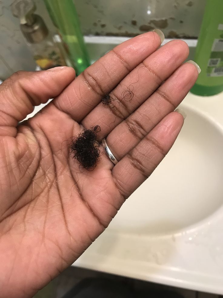 A small amount of shed coily hair resting in an open palm, showing a normal, healthy amount of daily hair loss.
