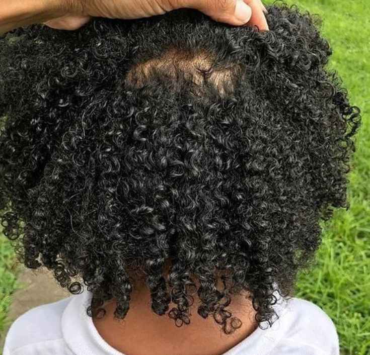 How to Keep Kids’ Scalp Healthy