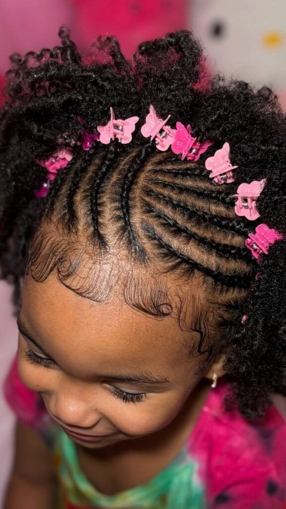 Toddler with a row of small clips lining the crown